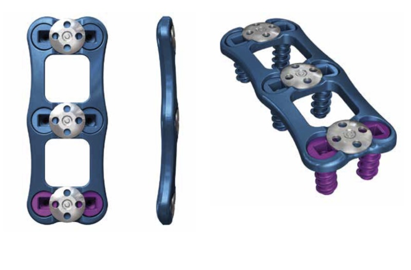 Ascential ACP 1 Anterior Cervical Plate