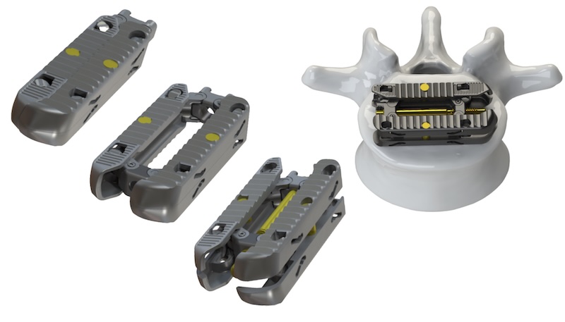 Product-detail | NeuroSpine