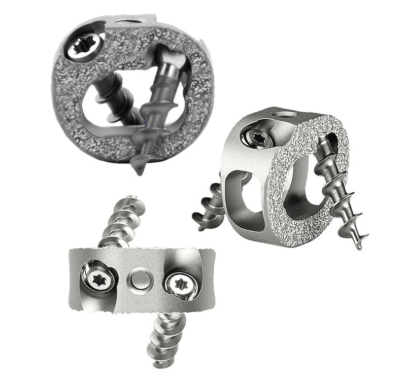 Product-detail | NeuroSpine