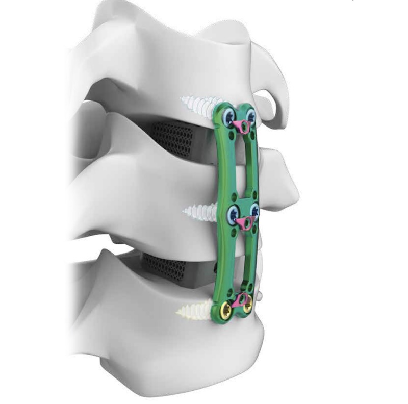 Product-detail | NeuroSpine